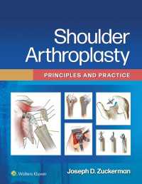 肩関節形成術：原理と実践<br>Shoulder Arthroplasty