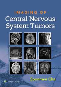 中枢神経系腫瘍画像法<br>Imaging of Central Nervous System Tumors