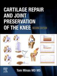 膝の軟骨修復・関節温存入門（第２版）<br>Cartilage Repair and Joint Preservation of the Knee（2）