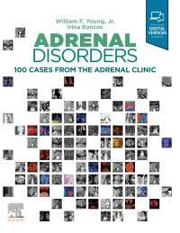 アドレナリン異常：臨床100事例<br>Adrenal Disorders,E-Book : Cases from the Adrenal Clinic