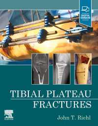 Tibial Plateau Fractures - E-Book