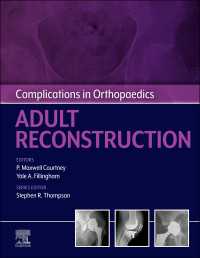 Complications in Orthopaedics: Adult Reconstruction - E-Book