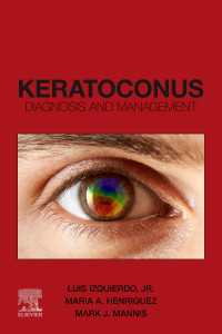 Keratoconus,E-Book : Diagnosis and Management