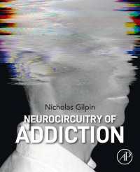 依存症の神経回路<br>Neurocircuitry of Addiction