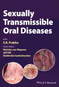 性感染口腔疾患<br>Sexually Transmissible Oral Diseases