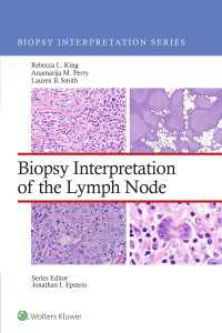 リンパ腺の生検診断<br>Biopsy Interpretation of the Lymph Nodes