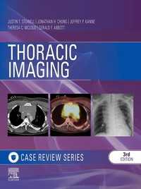 胸部画像診断：ケース・レビュー（第３版）<br>Thoracic Imaging: Case Review Series E-Book（3）