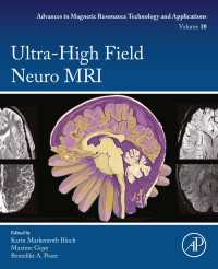 超高磁場神経MRI<br>Ultra-High Field Neuro MRI