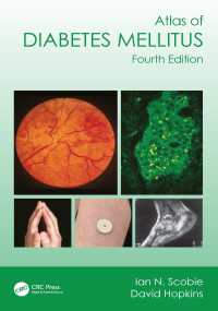 糖尿病アトラス（第４版）<br>Atlas of Diabetes Mellitus（4）