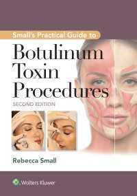 ボツリヌス毒処置の実践ガイド（第２版）<br>Small's Practical Guide to Botulinum Toxin Procedures（2）