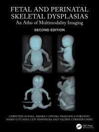 Fetal and Perinatal Skeletal Dysplasias : An Atlas of Multimodality Imaging（2）