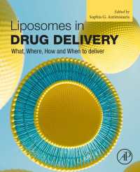 Liposomes in Drug Delivery : What, Where, How and When to deliver