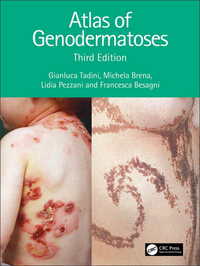遺伝性皮膚疾患アトラス（第３版）<br>Atlas of Genodermatoses（3）