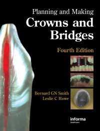 クラウン・ブリッジ製作（第４版）<br>Planning and Making Crowns and Bridges（4）