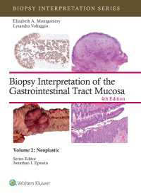 Biopsy Interpretation of the Gastrointestinal Tract Mucosa Volume 2 : Neoplastic: eBook without Multimedia（4）