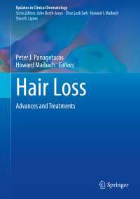 Hair Loss : Advances and Treatments