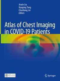 COVID-19患者の胸部画像法アトラス<br>Atlas of Chest Imaging in COVID-19 Patients