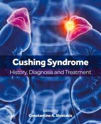 Cushing Syndrome : History, Diagnosis and Treatment