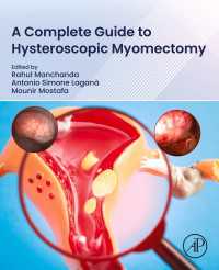 A Complete Guide to Hysteroscopic Myomectomy