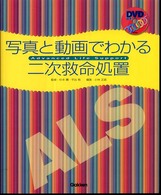 写真と動画でわかる二次救命処置 - ＡＬＳ