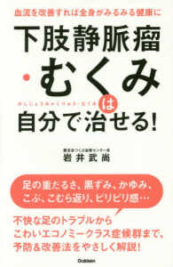 下肢静脈瘤・むくみは自分で治せる！ - 血流を改善すれば全身がみるみる健康に