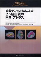 拡散テンソル法によるヒト脳白質のＭＲＩアトラス―ＭＲＩ　Ａｔｌａｓ　ｏｆ　Ｈｕｍａｎ　Ｗｈｉｔｅ　Ｍａｔｔｅｒ