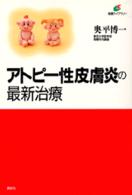 アトピー性皮膚炎の最新治療 健康ライブラリー