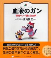 血液のガン - 悪性リンパ腫と白血病 健康ライブラリーイラスト版