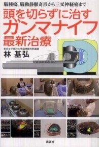 頭を切らずに治すガンマナイフ最新治療 - 脳腫瘍、脳動静脈奇形から三叉神経痛まで 健康ライブラリースペシャル