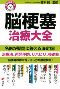 脳梗塞治療大全 - 名医が答える！ 健康ライブラリー