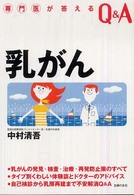 乳がん - 発見・検査・治療・再発防止策・タイプ別くわしい体験 専門医が答えるＱ＆Ａ