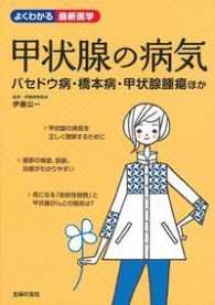 甲状腺の病気 - バセドウ病・橋本病・甲状腺腫瘍ほか よくわかる最新医学