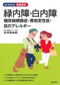 緑内障・白内障糖尿病網膜症・黄斑変性症・目のアレルギー よくわかる最新医学