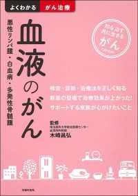 血液のがん - 悪性リンパ腫・白血病・多発性骨髄腫 よくわかるがん治療