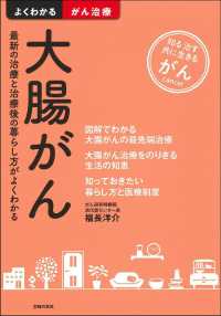 大腸がん - 最新の治療と治療後の暮らし方がよくわかる よくわかる最新医学シリーズ