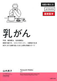乳がん 名医が教えるよくわかる最新医学シリーズ