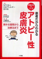 患者だからわかるアトピー性皮膚炎 - 素朴な疑問から治療法まで　患者の会がつくる