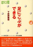 足にこぶができる - 下肢静脈瘤 ＮＨＫきょうの健康