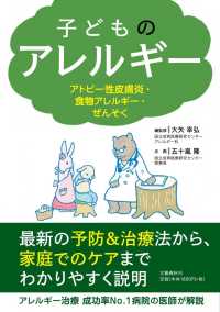 子どものアレルギー - アトピー性皮膚炎・食物アレルギー・ぜんそく