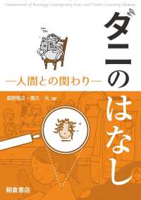 ダニのはなし - 人間との関わり