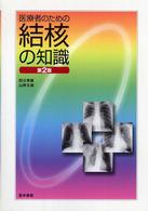 医療者のための結核の知識