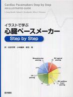 イラストで学ぶ心臓ペースメーカーｓｔｅｐ　ｂｙ　ｓｔｅｐ