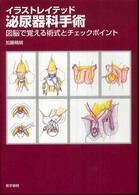 イラストレイテッド泌尿器科手術 - 図脳で覚える術式とチェックポイント