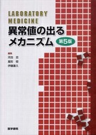 異常値の出るメカニズム （第５版）