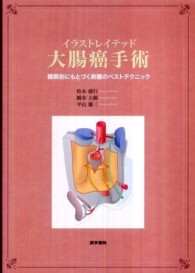 イラストレイテッド大腸癌手術 - 膜解剖にもとづく剥離のベストテクニック