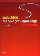 胸部大動脈瘤ステントグラフト内挿術の実際