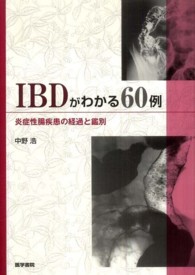 ＩＢＤがわかる６０例 - 炎症性腸疾患の経過と鑑別