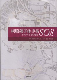 網膜硝子体手術ＳＯＳ - トラブルとその対策