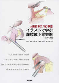 大阪日赤ラパロ教室イラストで学ぶ腹腔鏡下胃切除 - ＤＶＤ付