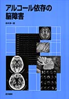 アルコール依存の脳障害